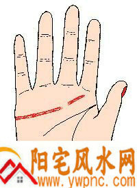 感情线在中指下中断,且两线牵连 感情线在中指下中断,且两线牵连