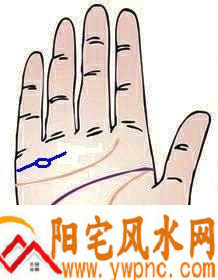 婚姻线上有岛纹代表什么? 婚姻线上有岛纹代表什么?